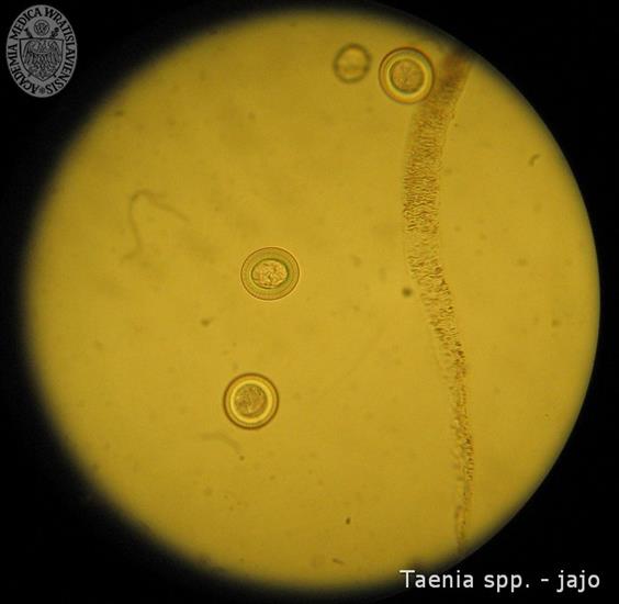 Parazytologia - Taenia spp. - jajo.jpg