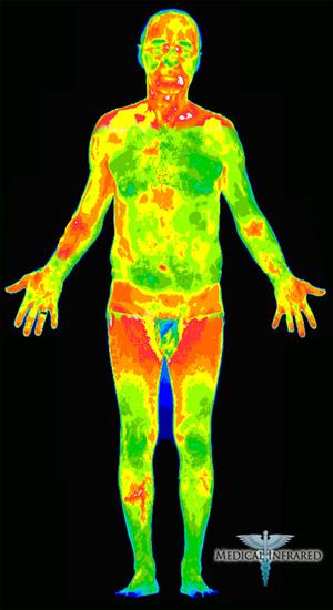 prezentacja - Thermal-Infrared-Full-Body-Scan2.jpg